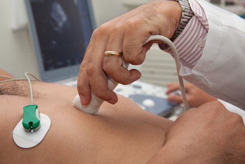 Echocardiogram Scan